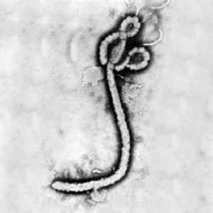 Foto "virus" Ebola